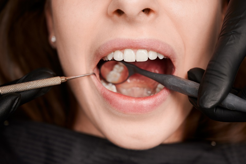 The Differences Between Cosmetic and Restorative Dentistry